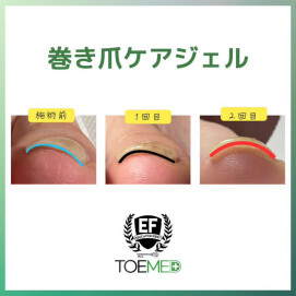M's nail　巻き爪ケアジェル始めました♪